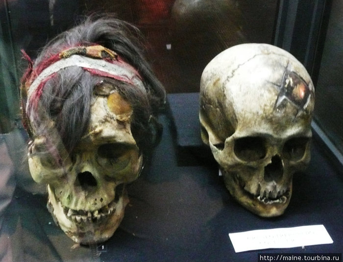 В музее золота.Лима. 2,000 лет назад при трансплантации черепа были вставлены золотые пластинки.